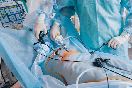 Laparoscopic Surgery